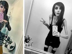 La youtuber Eugenia Cooney, que apenas pesa 27 kilos, es acusada de inducir a la anorexia. La youtuber Eugenia Cooney, que apenas pesa 27 kilos, es acusada de inducir a la anorexia.