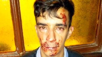 brutal ataque de una patota de adolescentes a un electricista en la plata brutal ataque de una patota de adolescentes a un electricista en la plata