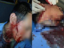 Moreno: le cortaron la cara a un colectivero tras una discusión por el boleto