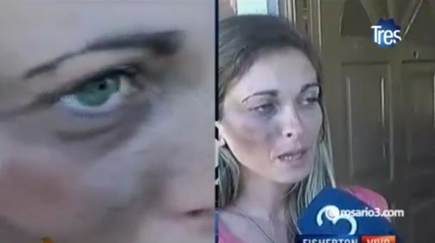 Violento asalto: le robaron, intentaron secuestrar a su hija y la golpearon