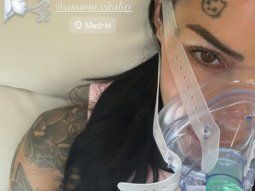 Qué es la terapia de hipoxia, el tratamiento que promociona Cande Tinelli