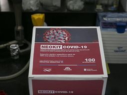 C&oacute;mo es el primer kit para detectar el coronavirus creado en el pa&iacute;s