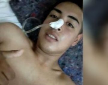 Gendarmería baleó por la espalda a un joven que intentó esquivar un control