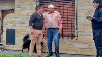 brutal golpiza a un hombre para robarle $300 mil en efectivo y joyas brutal golpiza a un hombre para robarle $300 mil en efectivo y joyas