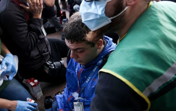 Según Lilia Lemoine, el fotógrafo reprimido por la Policía interceptó el gas pimienta con la cara