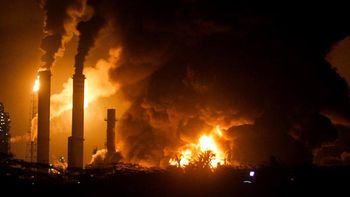 argentina dona piel a heridos en explosion de una refineria argentina dona piel a heridos en explosion de una refineria