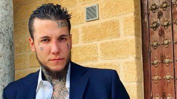 alex caniggia se borro los tatuajes de su cara y sorprendio con su nueva apariencia: ¡mira! alex caniggia se borro los tatuajes de su cara y sorprendio con su nueva apariencia: ¡mira!