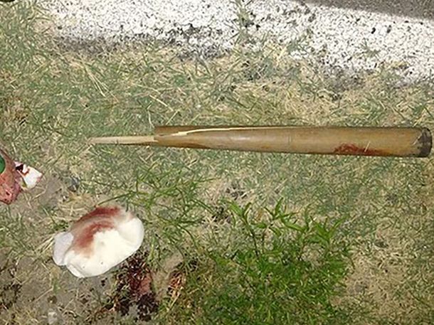 Pilar: un joven dejó con muerte cerebral a su tío tras golpearlo con un bate de béisbol