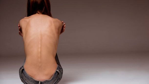 Trastornos alimenticios: es la tercera enfermedad crónica más común entre las jóvenes