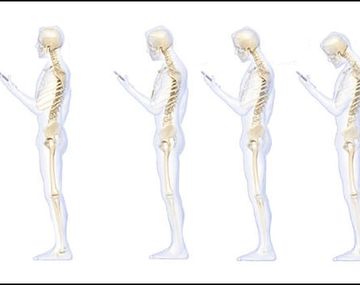 Cómo afecta a la columna el uso prolongado del celular