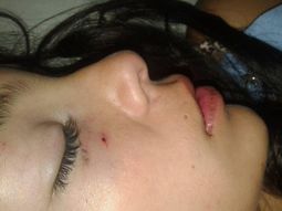 Denunció que su ex novio la desmayó a piñas y patadas