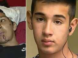 indignante: al bomberito heroe le robaron el celular y le tajearon la mano indignante: al bomberito heroe le robaron el celular y le tajearon la mano