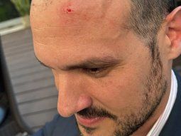 agredieron a dos diputados libertarios que iban a dar una charla en la universidad de la plata agredieron a dos diputados libertarios que iban a dar una charla en la universidad de la plata