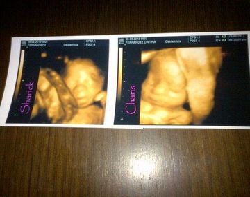 La primera imagen de las gemelas de Cinthia Fernández