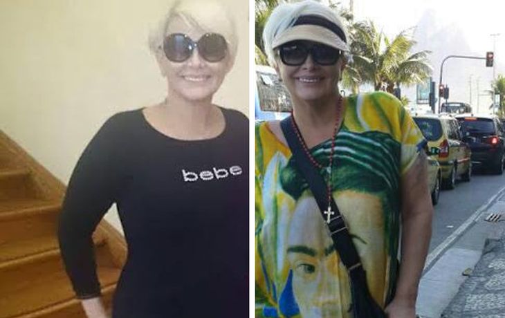 El antes y el después de Carmen Barbieri tras la cirugía
