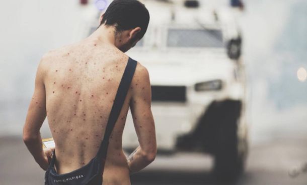 Manifestante desnudo en una autopista de Caracas se viralizó