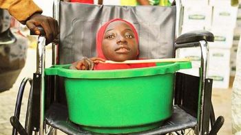 Rahma Haruna la joven sin cuerpo que vivía en un balde Rahma Haruna la joven sin cuerpo que vivía en un balde