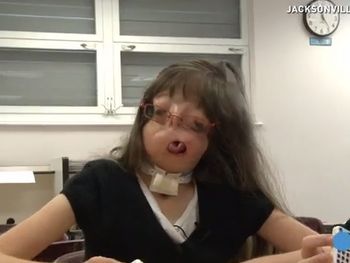 VIDEO: El conmovedor caso de una niña que nació sin cara