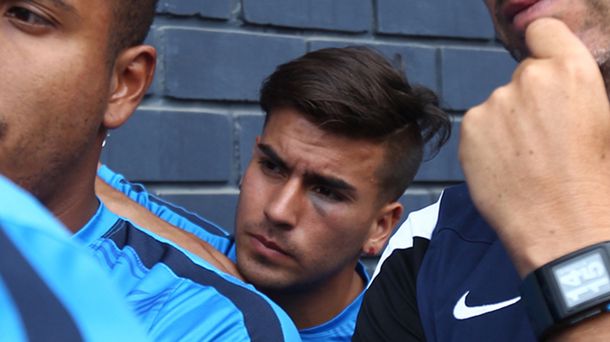 Brutal ataque de barras a jugadores de Alianza Lima: cuatro heridos