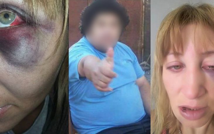 Su ex la gatilló dos veces, la pateó y luego le pegó con palo en amasar