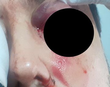 Habló la esposa del hombre que perdió el ojo tras una golpiza por el chat de mamis