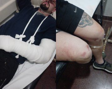 Increíble: baleó a su exyerno en el gimnasio para vengar la muerte de su hijo
