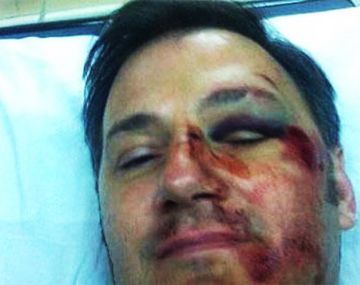 El director agredido celebró la sentencia ejemplar