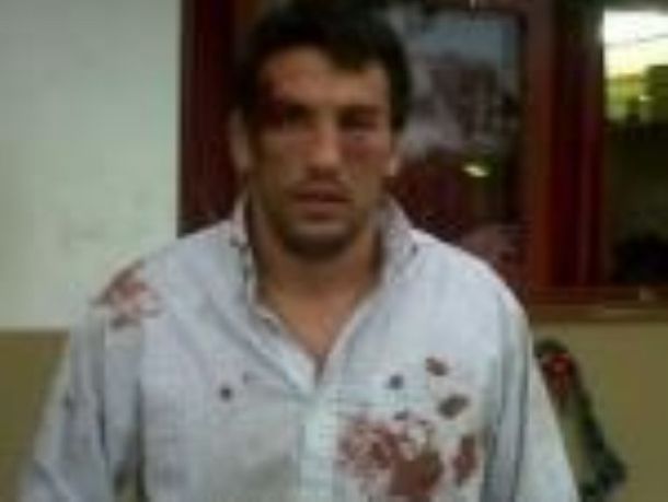 Confundieron a un rugbier con un delincuente y le dieron una feroz golpiza