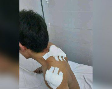 Apuñaló a su compañero porque se puso de novio con su hermana