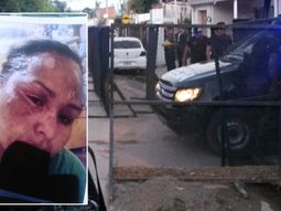 Una presa le quemó la cara con agua hirviendo&nbsp;