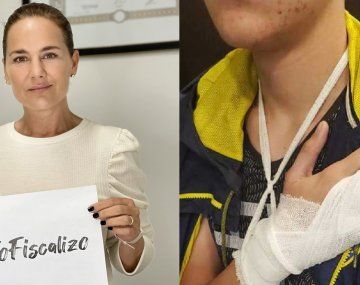 Denuncian que el hijo rugbier de una concejala macrista golpeó brutalmente a otro joven