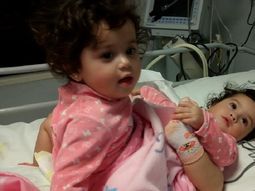 operan en el hospital posadas a las siamesas de 15 meses para intentar separarlas operan en el hospital posadas a las siamesas de 15 meses para intentar separarlas