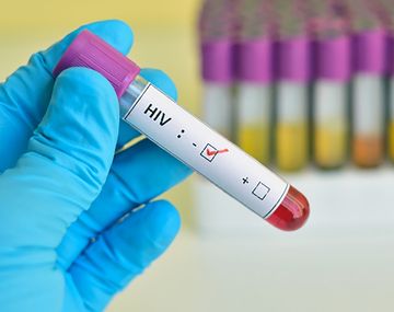 Avanza la cura del VIH con trasplantes de células madre