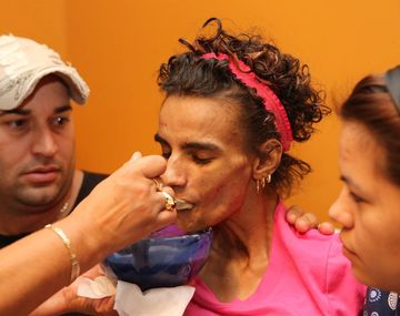 Una mujer quedó parapléjica tras un implante de senos