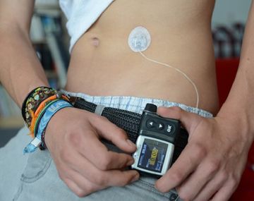 Le robaron la bomba de insulina - Crédito: diabetesdietas.com