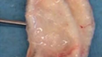 crean una oreja artificial con impresora 3d y celulas de oveja crean una oreja artificial con impresora 3d y celulas de oveja