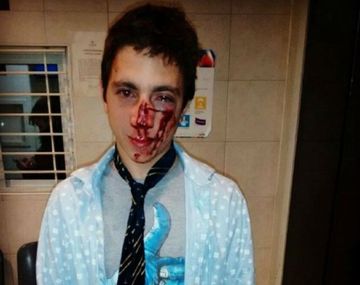 Bautista Beco mostró cómo quedó tras ser golpeado por una patota a la salida de un boliche