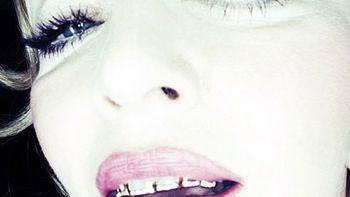 madonna ahora marca tendencia con sus raras fundas dentales madonna ahora marca tendencia con sus raras fundas dentales