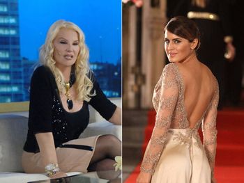 ¿Por qué Susana Gimenez nunca se hizo cirugías?