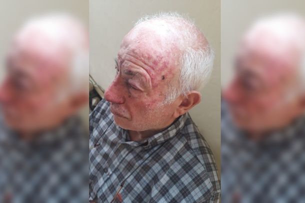 Encapuchados golpearon y maniataron a una pareja de jubilados en Luis Guillón