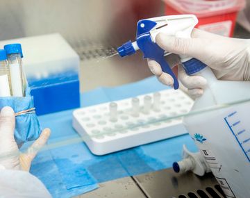 Coronavirus: en septiembre estarían los resultados de los primeros ensayos de una posible vacuna