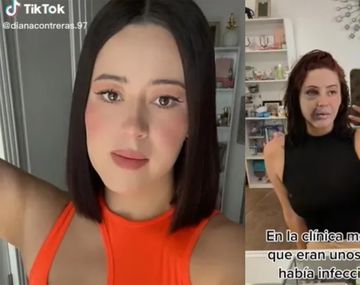 Tiktoker se hizo bichectomía y lipopapada: quedó desfigurada