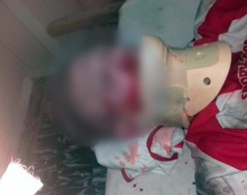 Un futbolista noqueó a otro