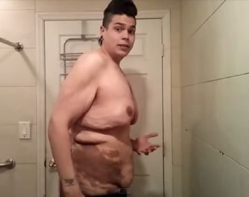 Mostró cómo quedó tras perder 122 kilos