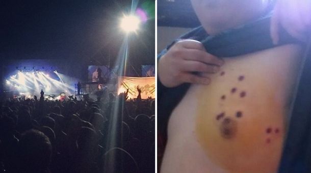 Un periodista denunció agresión policial en un recital de La Renga