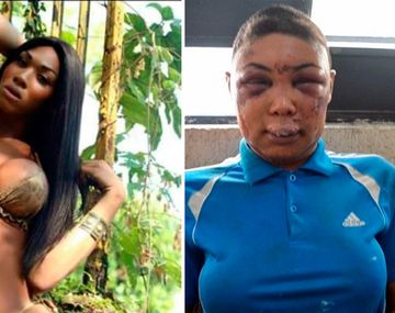 Conmoción por la trans desfigurada por la Policía de Brasil