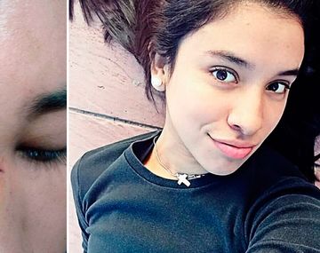 Se resistió a besar a un chico y le cortaron la cara con un vaso