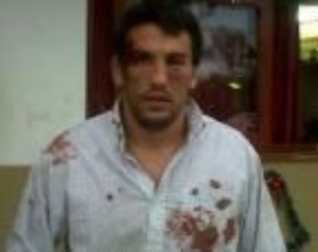 Policías golpean ferozmente a un rugbier por error