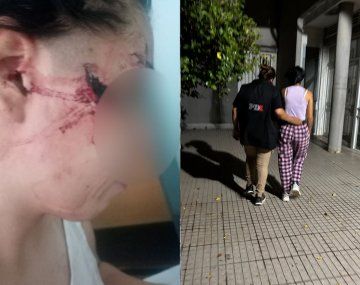 Horror en Santa Fe: atacaron a cuchillazos a una adolescente de 15 años y le desfiguraron la cara