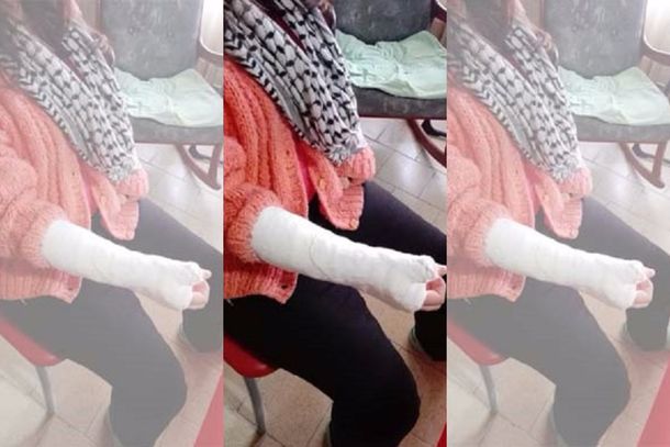 La obligaron a comer pasto y le fracturaron los dedos&nbsp;